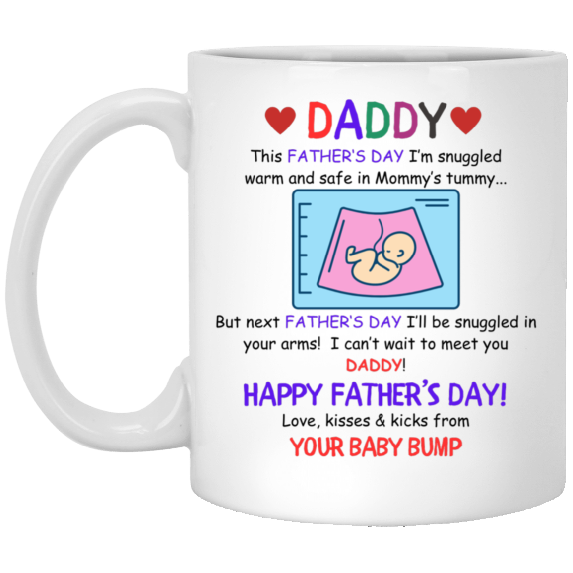 DADDY XP8434 11oz White Mug CustomCat